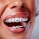 orthodontics las vegas